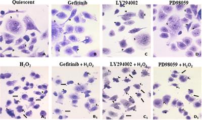 Effects of H2O2 Treatment Combined With PI3K Inhibitor and MEK Inhibitor in AGS Cells: Oxidative Stress Outcomes in a Model of Gastric Cancer